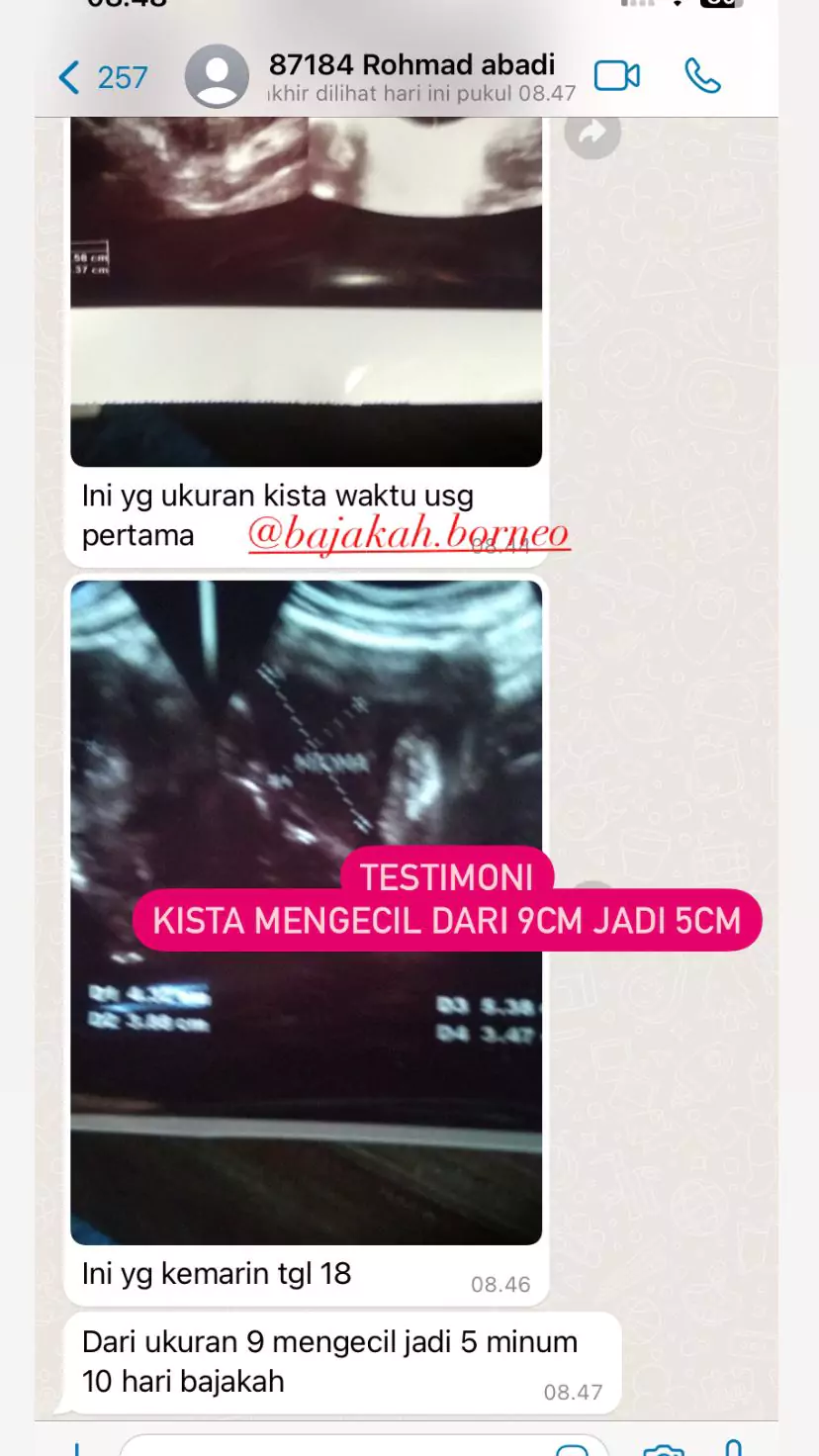 whatsapp-image-2025-04-28-at-141716-68105822e8cb6